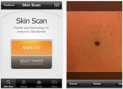 SkinScan